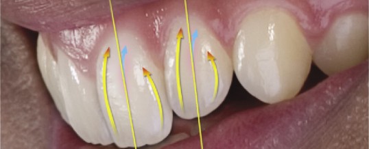 Anterior Anatomy & The Science of a Natural Smile Intro